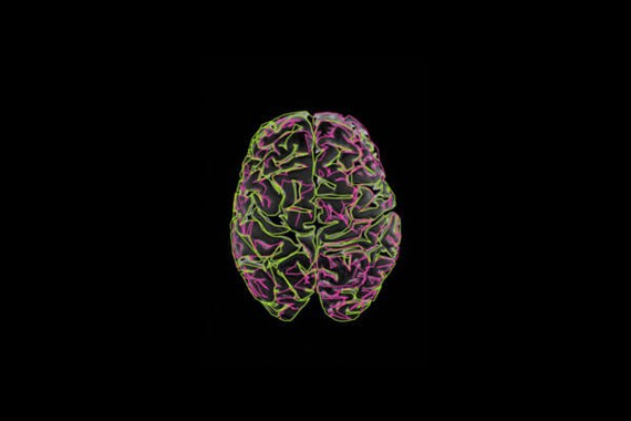Live-wired Brain